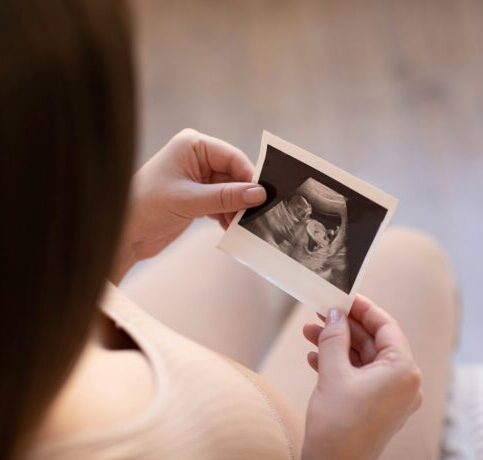 a pregnant girl holds in her hands a photo from an ultrasonic study of her unborn child